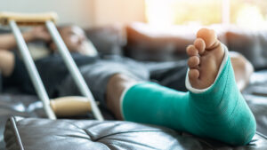 The Most Common Types of Broken Bones